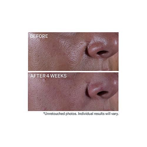 Super Shrink Pore Minimizing Serum