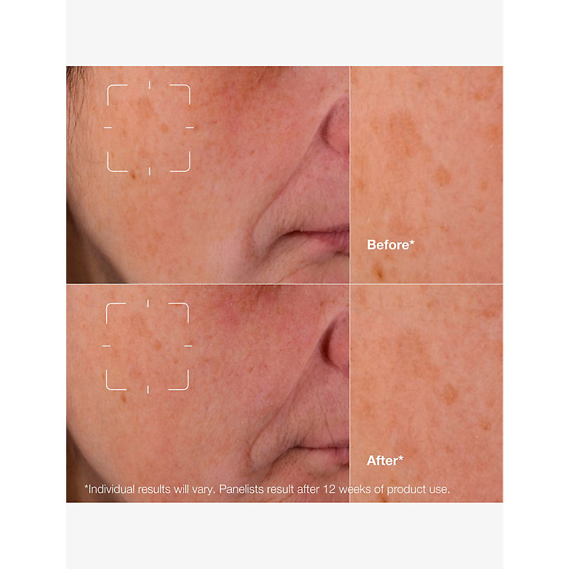Even Better Clinical Dark Spot Clearing Serum 50ml