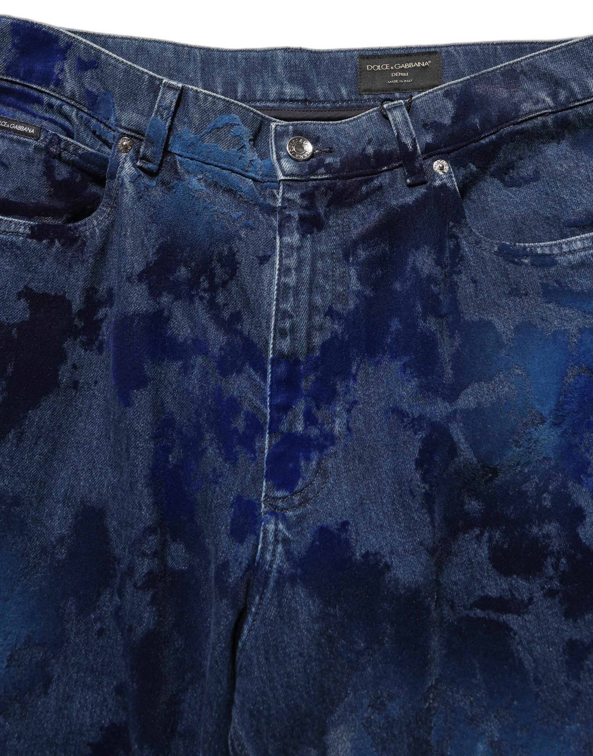 Tie-Dye Cotton Jeans — Blue