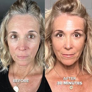 12 Month Supply - Collagen Mask