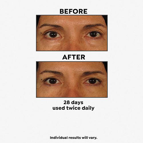 2-pack No More Baggage Eye Gel