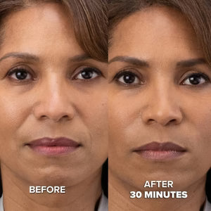 12 Month Supply - Collagen Mask