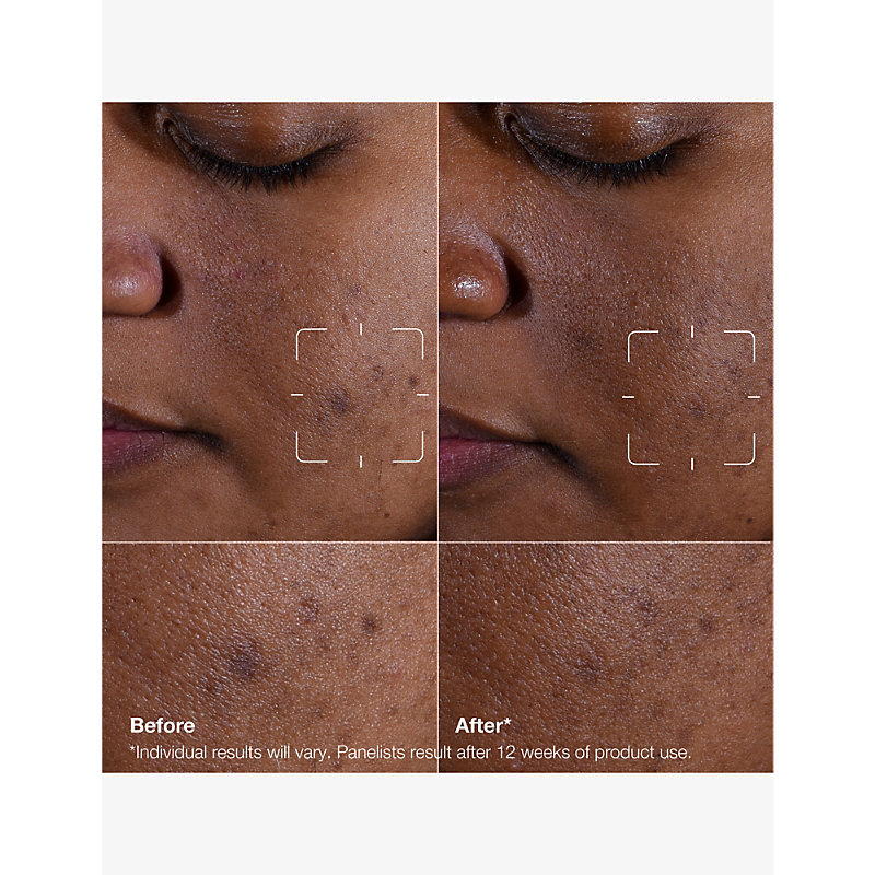 Even Better Clinical Dark Spot Clearing Serum 50ml