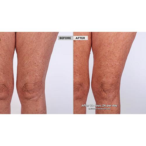 Lancôme 2-pack Nutrix Royal Body Balm