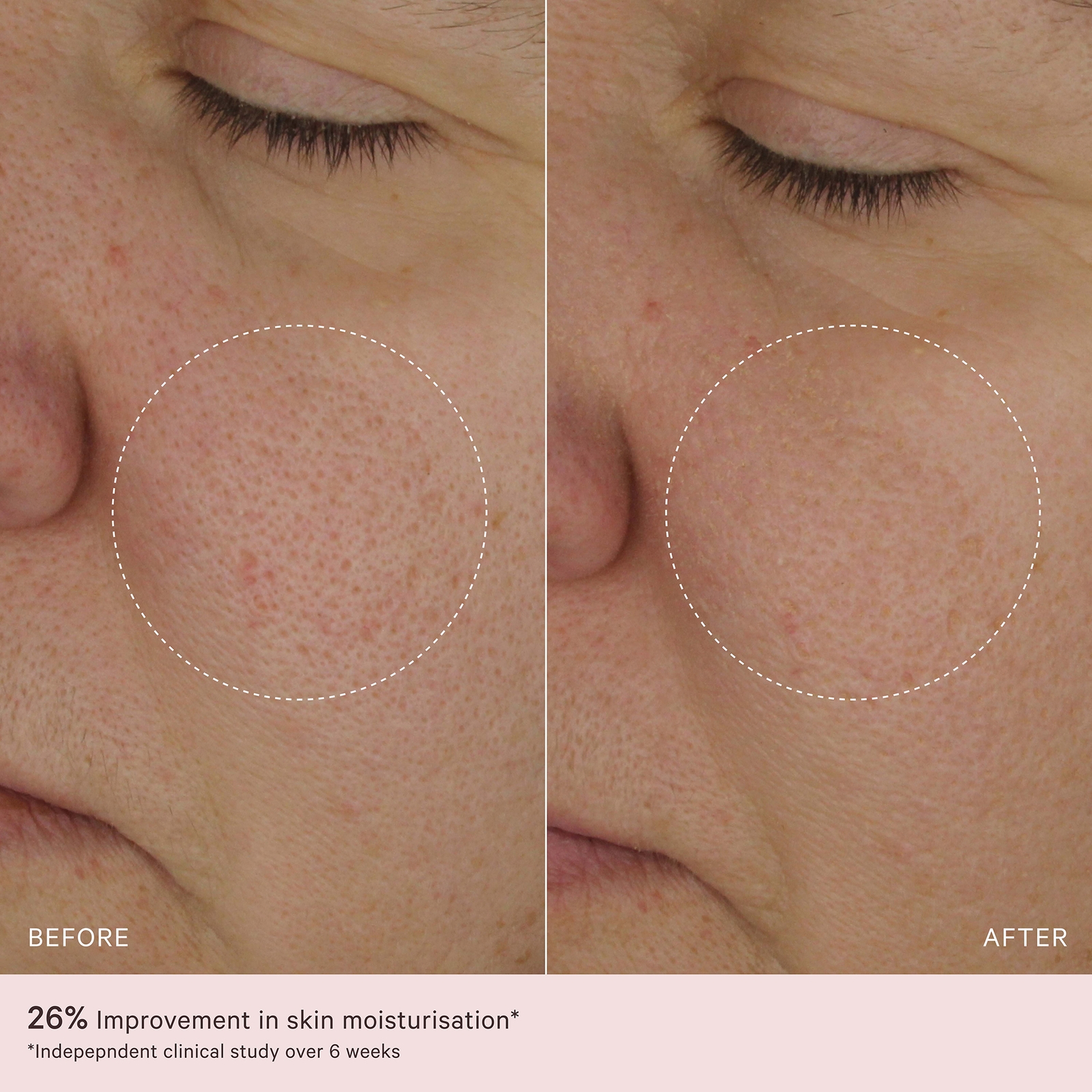 MZ Skin The Light Moisturiser in Beauty: NA