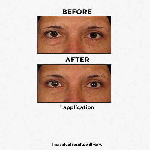 2-pack No More Baggage Eye Gel