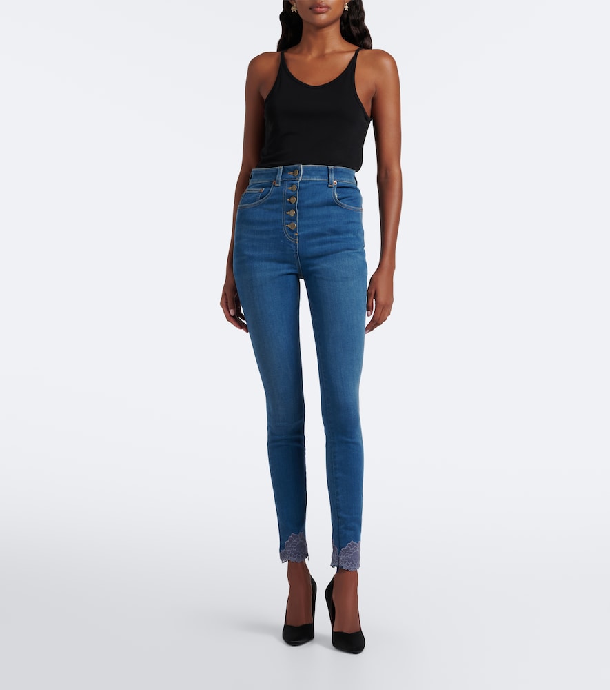 Lace-trimmed skinny jeans