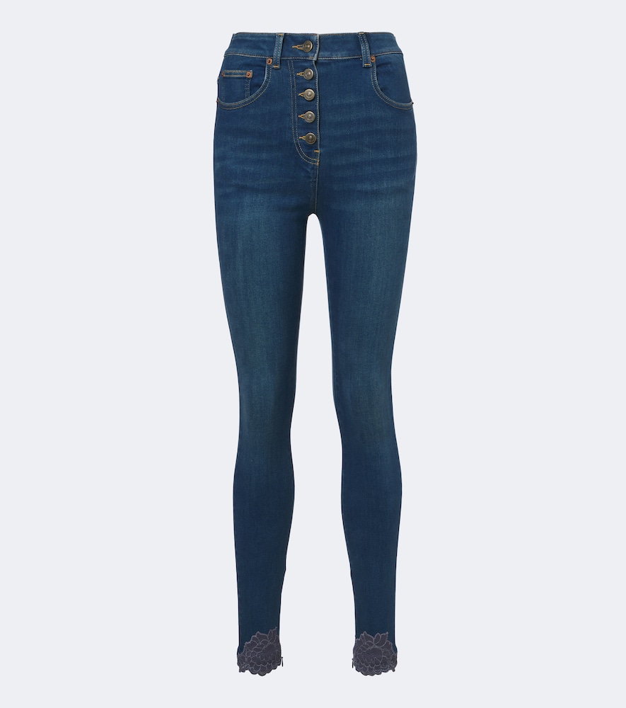 Lace-trimmed skinny jeans