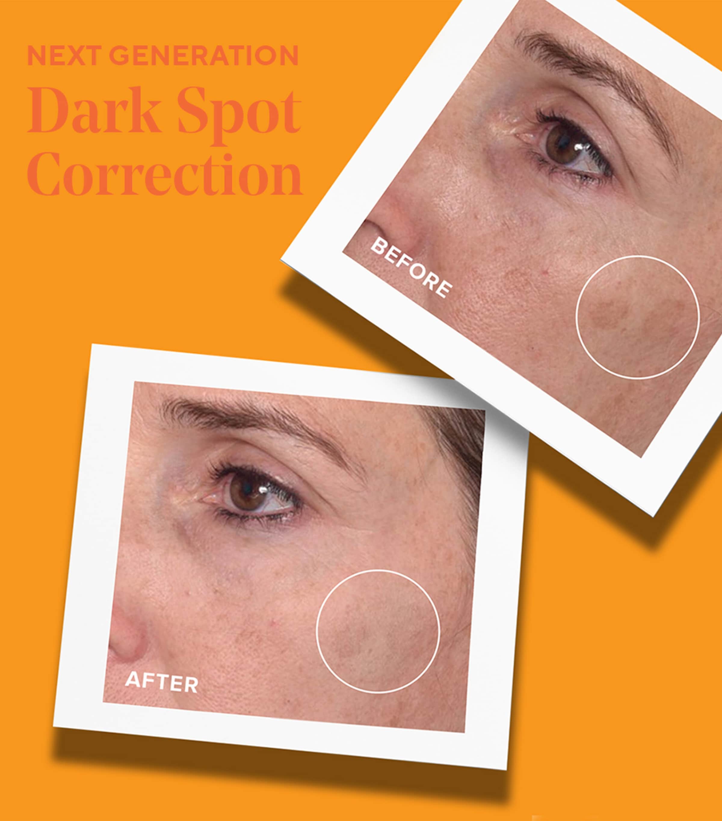 Rapid Dark Spot Correcting Serum