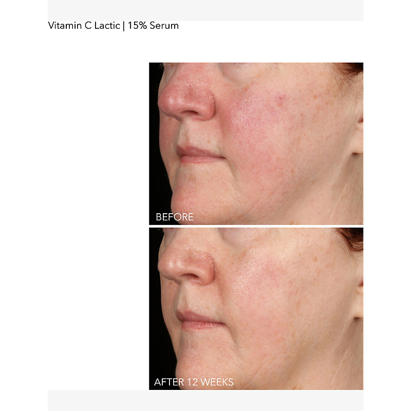 15% Vitamin C Firm & Bright Serum 30ml