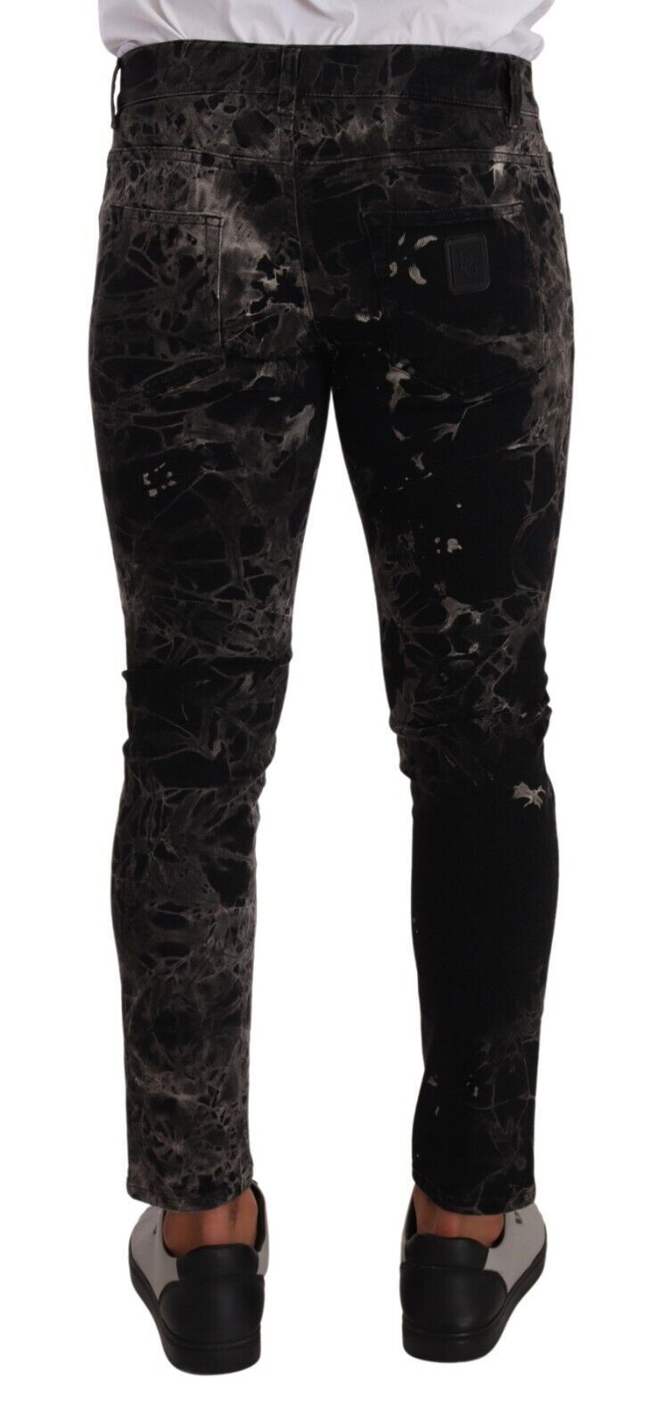 Patterned Skinny Jeans — Black