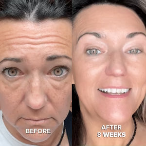 12 Month Supply - Collagen Mask