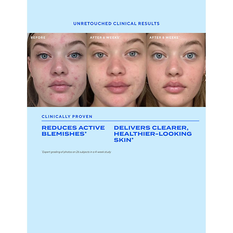 Biome-Balancing Clear and Prevent Blemish Treatment Serum 30ml