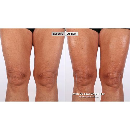 Lancôme 2-pack Nutrix Royal Body Balm